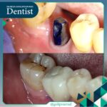 دکتر رضا قلی پور راد در بابل