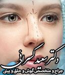 جراح پلاستیک بینی دکتر کسرائی در فارس