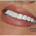 دکتر مهدیه جمشیدیان در تهران