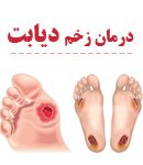 درمان زخم دیابت در رشت
