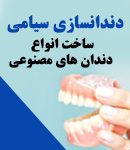 دندانسازی سیامی در اصفهان