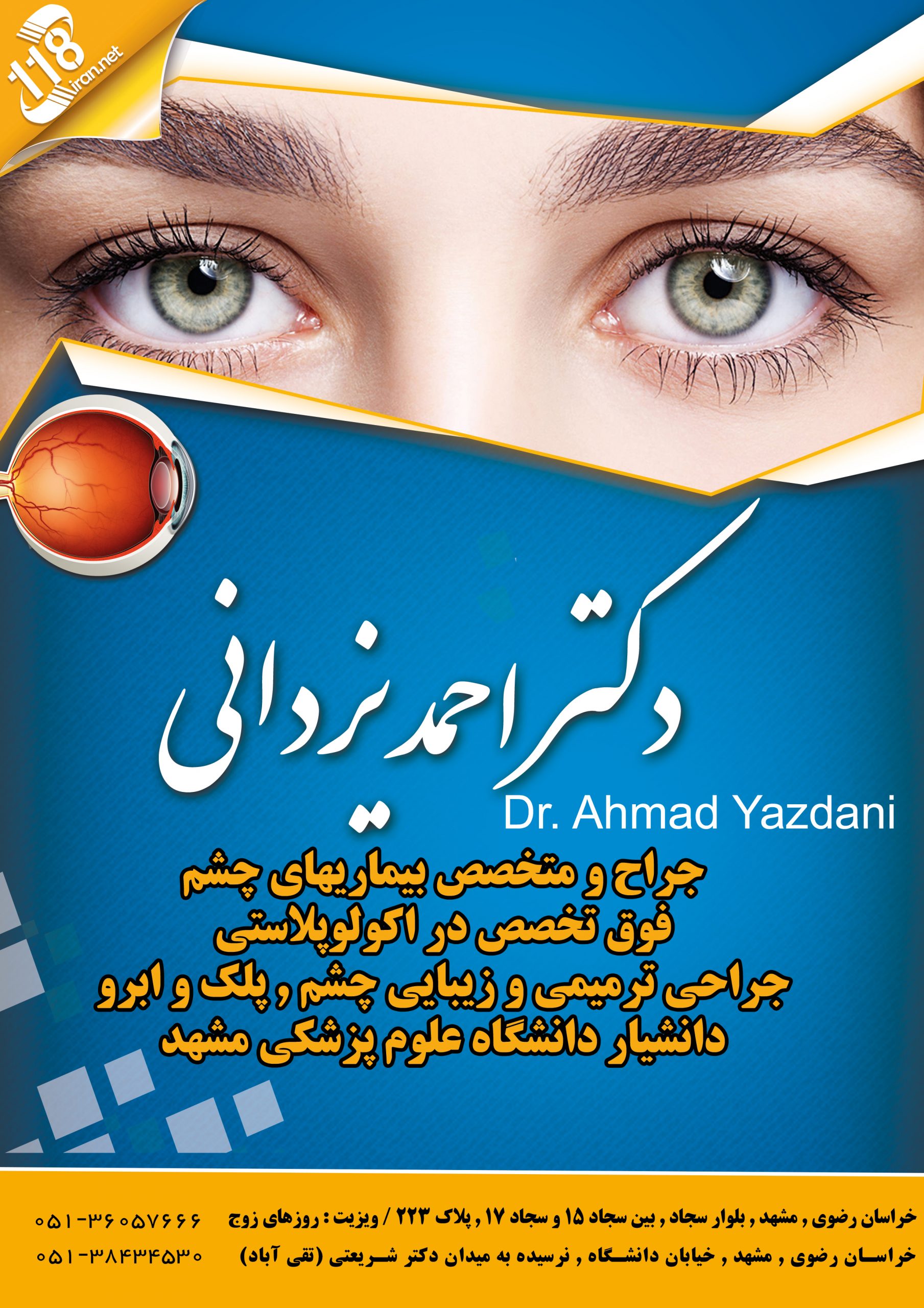 دکتر احمد یزدانی بلفاروپلاستی در مشهد