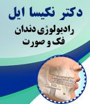 رادیولوژی دندان فک و صورت دکتر نکیسا ایل در سعادت آباد تهران