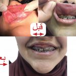 کلینیک دندانپزشکی دکتر راستگو در آبادان و تهران