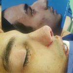 دکتر غلامحسین رضاپور در تهران