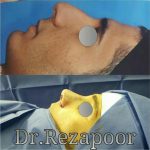 دکتر غلامحسین رضاپور در تهران