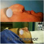 دکتر غلامحسین رضاپور در تهران