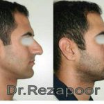 دکتر غلامحسین رضاپور در تهران