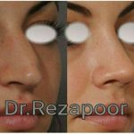 دکتر غلامحسین رضاپور در تهران