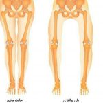 مرکز توانبخشی و فیزیوتراپی رضا مرادی فر در خیابان آیت الله کاشانی منطقه 5 در تهران