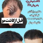 دکتر علی مقصودلو در گرگان