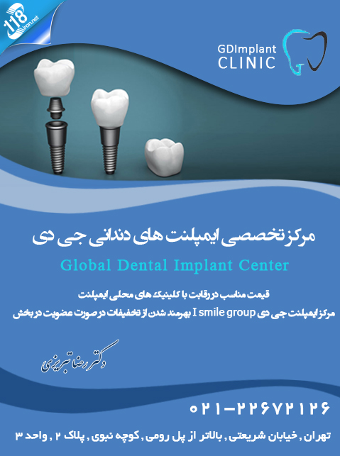 مرکز تخصصی ایمپلنت های دندانی جی دی