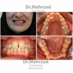 دکتر جبرئیل مهرزاد در بروجرد