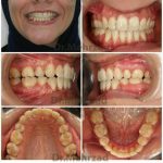 دکتر جبرئیل مهرزاد در بروجرد