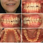 دکتر جبرئیل مهرزاد در بروجرد