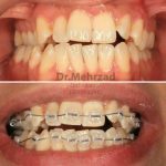 دکتر جبرئیل مهرزاد در بروجرد