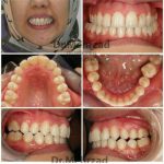 دکتر جبرئیل مهرزاد در بروجرد