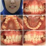 دکتر جبرئیل مهرزاد در بروجرد