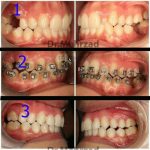 دکتر جبرئیل مهرزاد در بروجرد