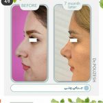 دکتر آیت پوزش در شیراز