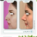 دکتر آیت پوزش در شیراز