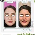 دکتر آیت پوزش در شیراز