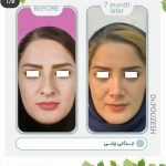 دکتر آیت پوزش در شیراز