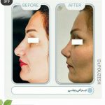 دکتر آیت پوزش در شیراز