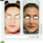 دکتر آیت پوزش در شیراز