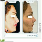 دکتر آیت پوزش در شیراز