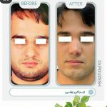 دکتر آیت پوزش در شیراز