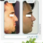 دکتر آیت پوزش در شیراز