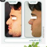 دکتر آیت پوزش در شیراز