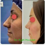 دکتر آیت پوزش در شیراز