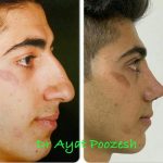 دکتر آیت پوزش در شیراز