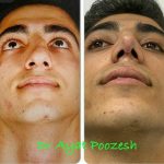 دکتر آیت پوزش در شیراز