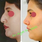 دکتر آیت پوزش در شیراز