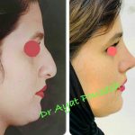 دکتر آیت پوزش در شیراز