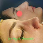 دکتر آیت پوزش در شیراز