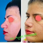 دکتر آیت پوزش در شیراز