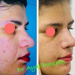 دکتر آیت پوزش در شیراز