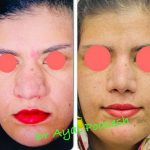 دکتر آیت پوزش در شیراز