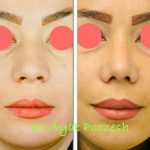 دکتر آیت پوزش در شیراز