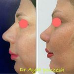 دکتر آیت پوزش در شیراز