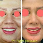 دکتر آیت پوزش در شیراز