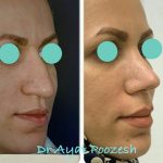 دکتر آیت پوزش در شیراز