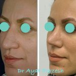 دکتر آیت پوزش در شیراز