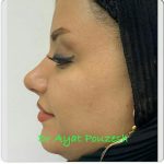 دکتر آیت پوزش در شیراز