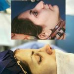 دکتر آیت پوزش در شیراز