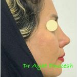 دکتر آیت پوزش در شیراز